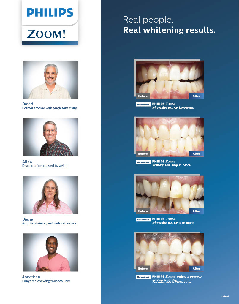 Teeth Whitening Columbus, OH Whittaker Dental Group